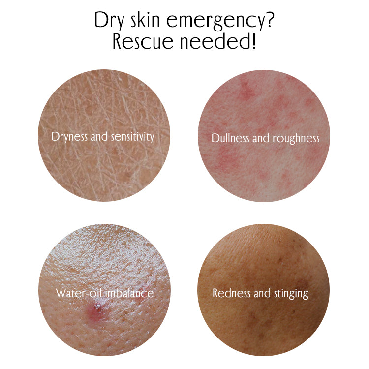 Dry skin emergency? Rescue needed!